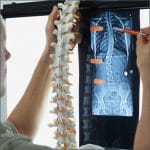 Spine Injury