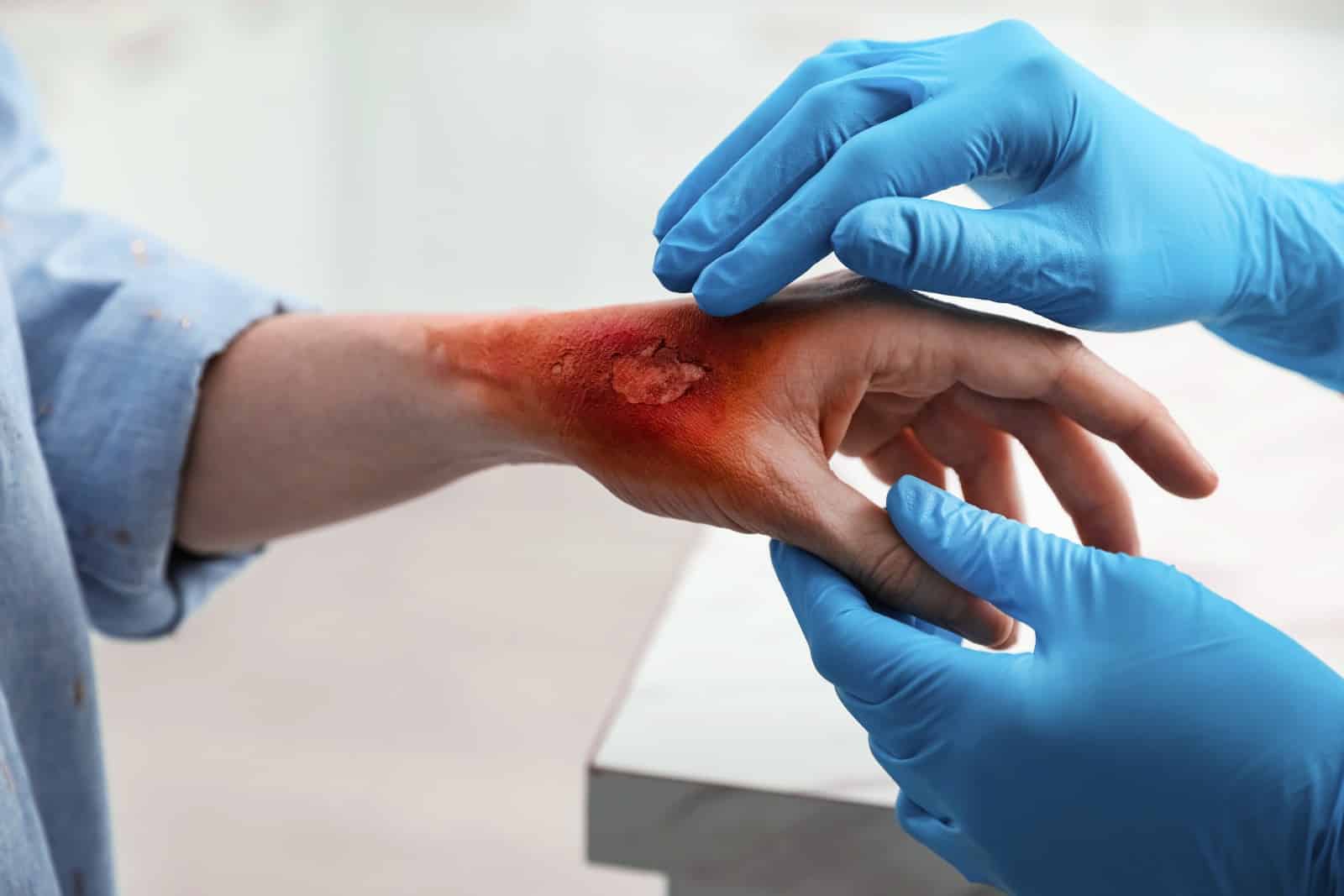 Neck Injury Lawyer Los Angeles thumbnail