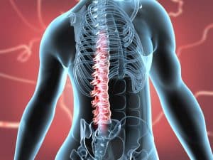 Spinal Cord Injuries and Pressure Ulcers